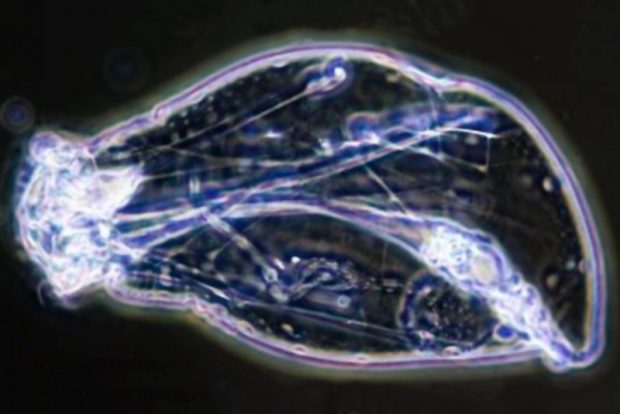 Asplanchna priodonta одна из наиболее крупных коловраток (живого микрокорма для мальков икромечущих рыб)
